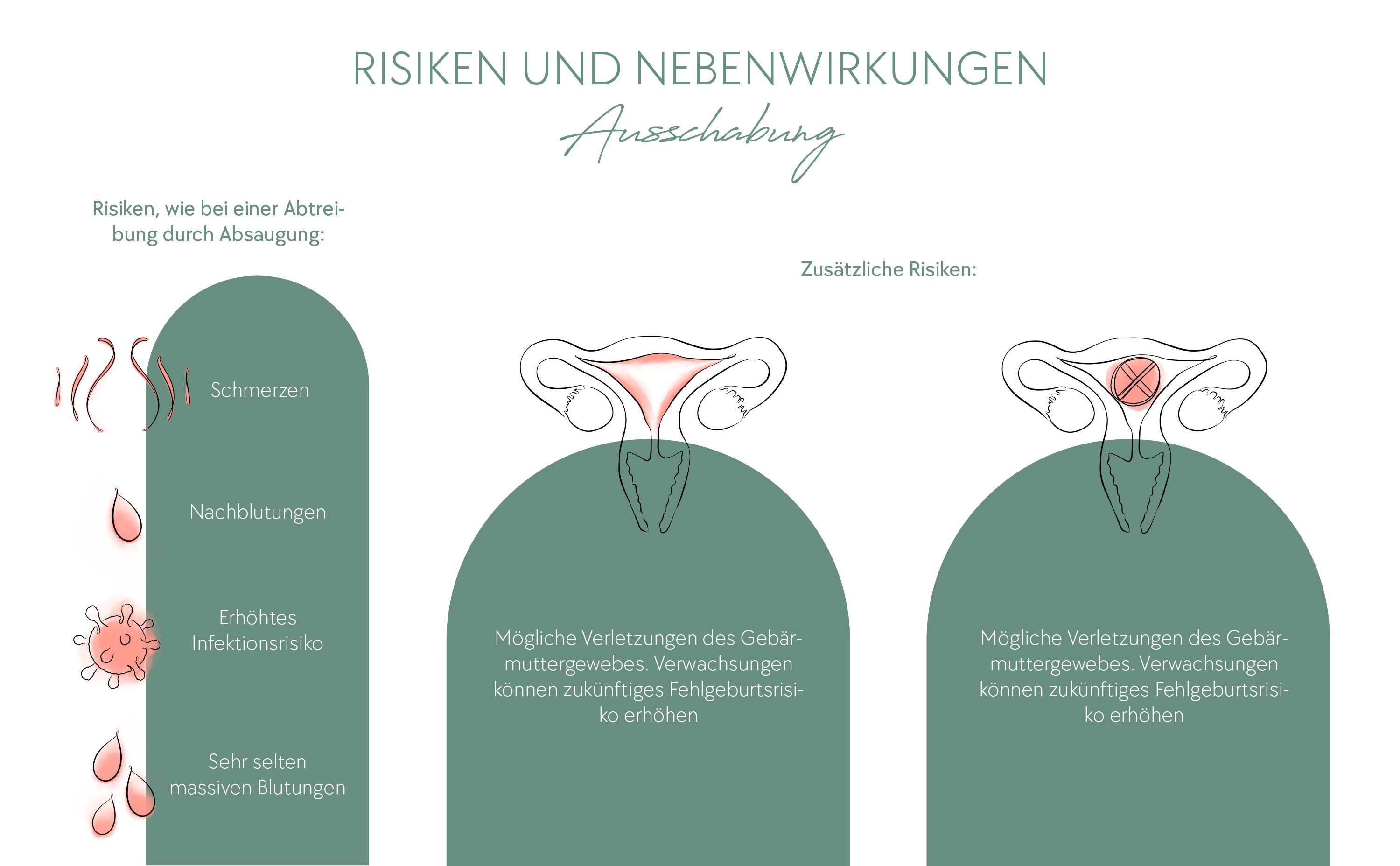 Wann Kann Ich Nach Einer Ausschabung Wieder Schwanger Werden Abtreibung durch Ausschabung (Curettage) | Profemina