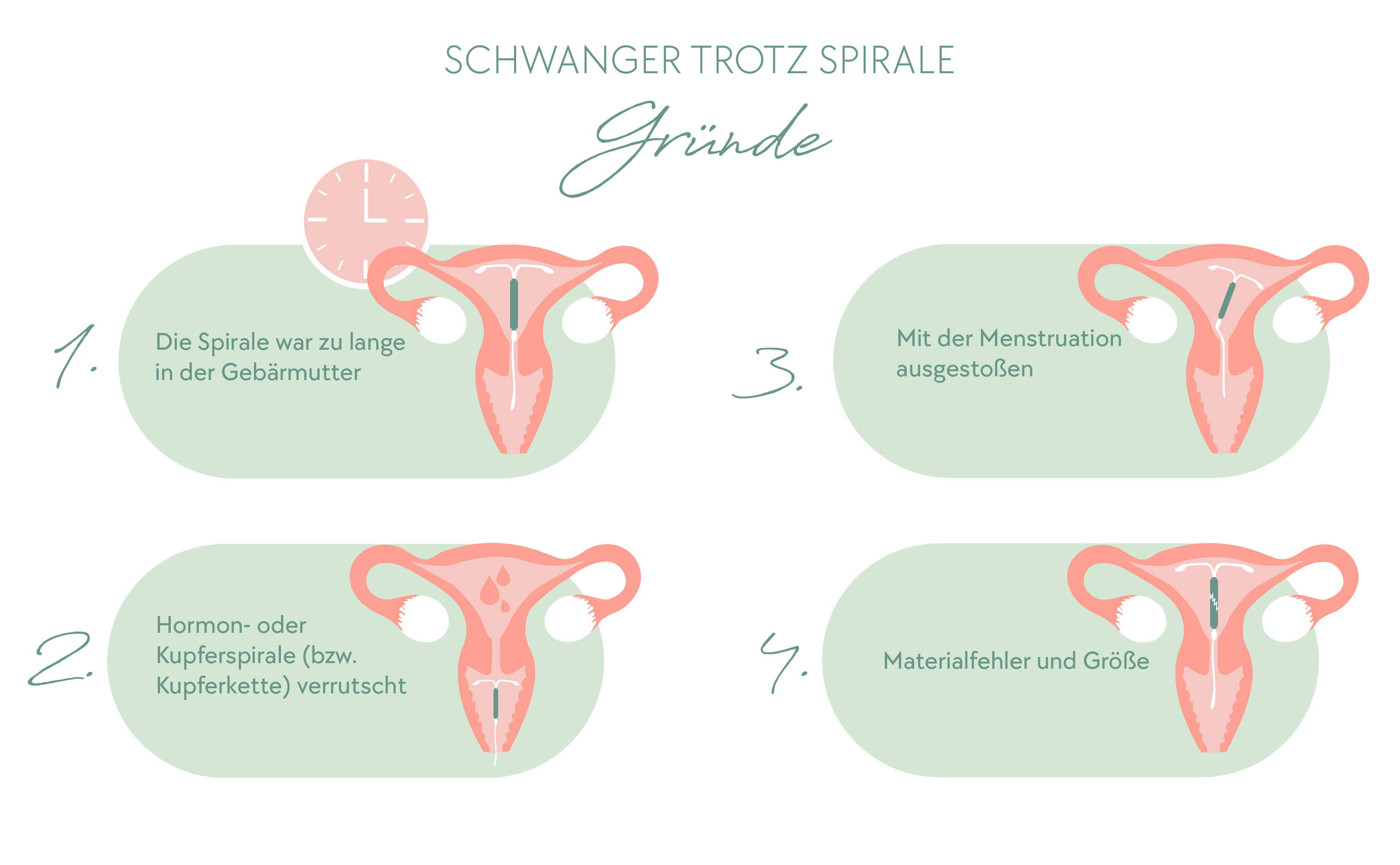 Schwanger trotz Spirale - Mögliche Gründe