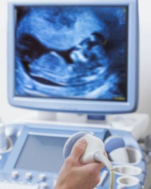 Ultrasound Requirement CS !