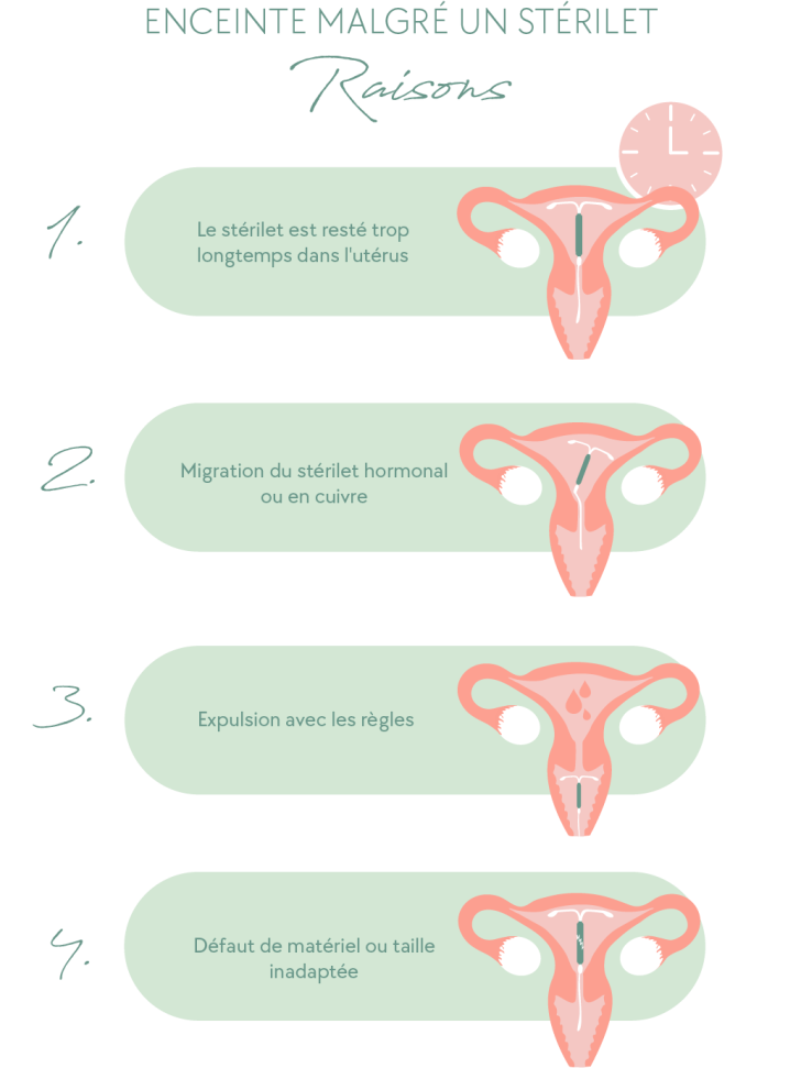 Enceinte malgré un stérilet raisons (mobile)