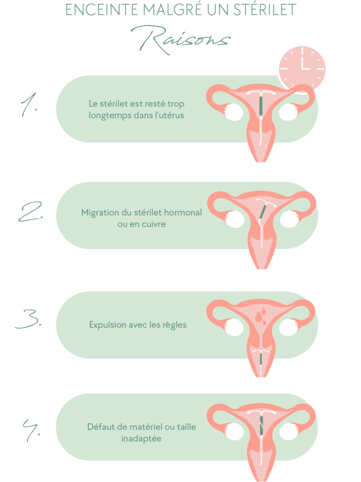 Enceinte malgré un stérilet raisons (mobile)