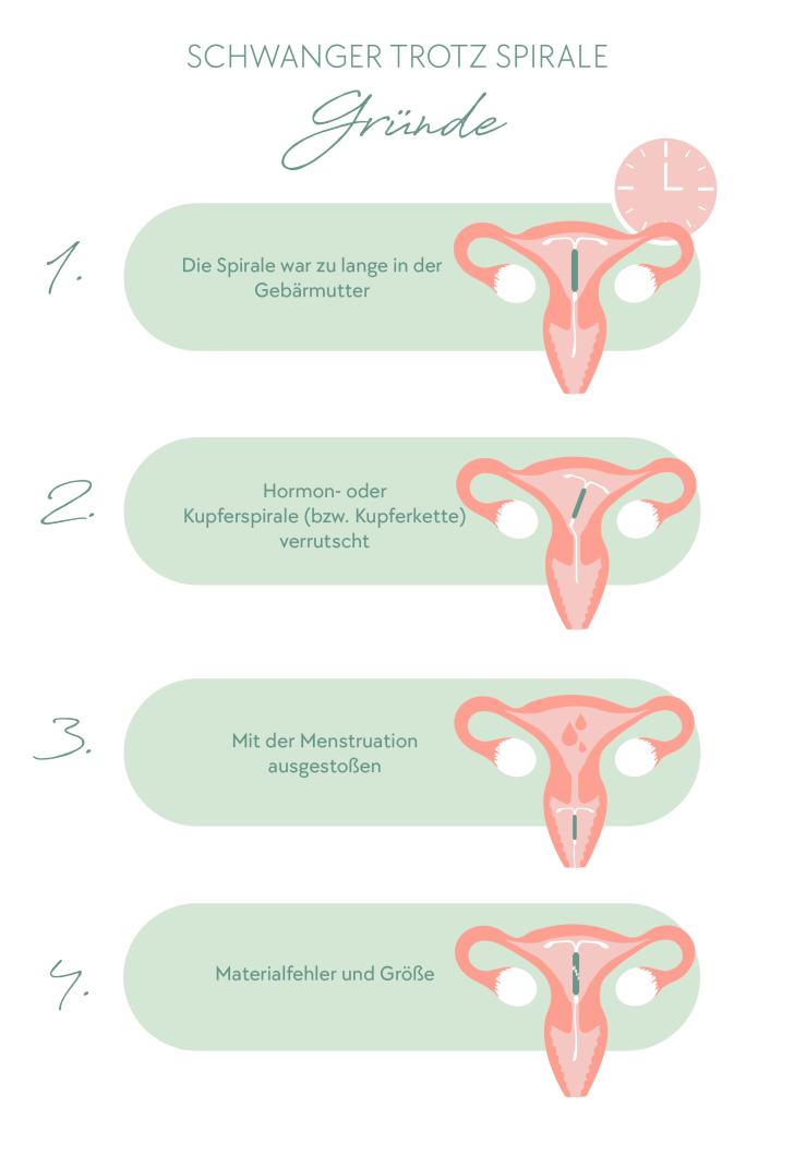 Schwanger trotz Spirale - Mögliche Gründe
