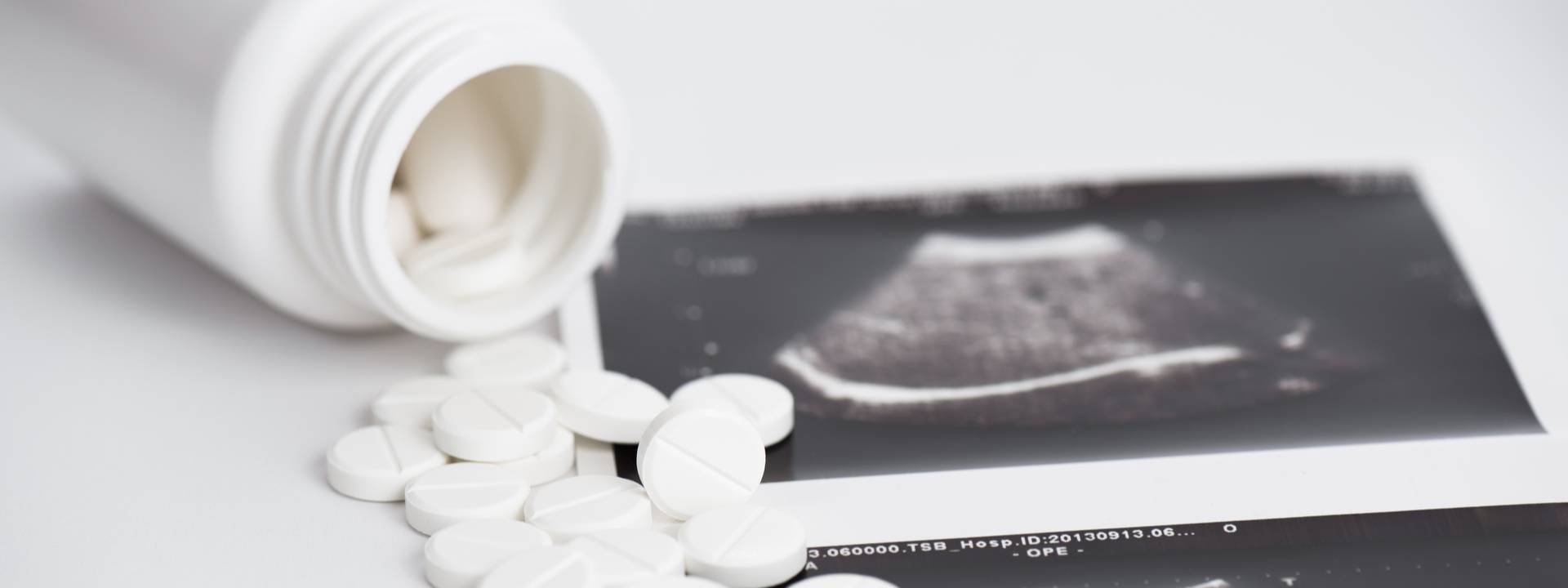 La pillola abortiva Mifegyne® o RU486